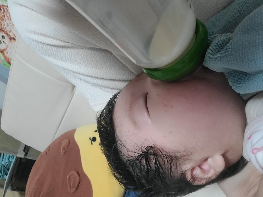 태열인지 아토피인지 고민이에요