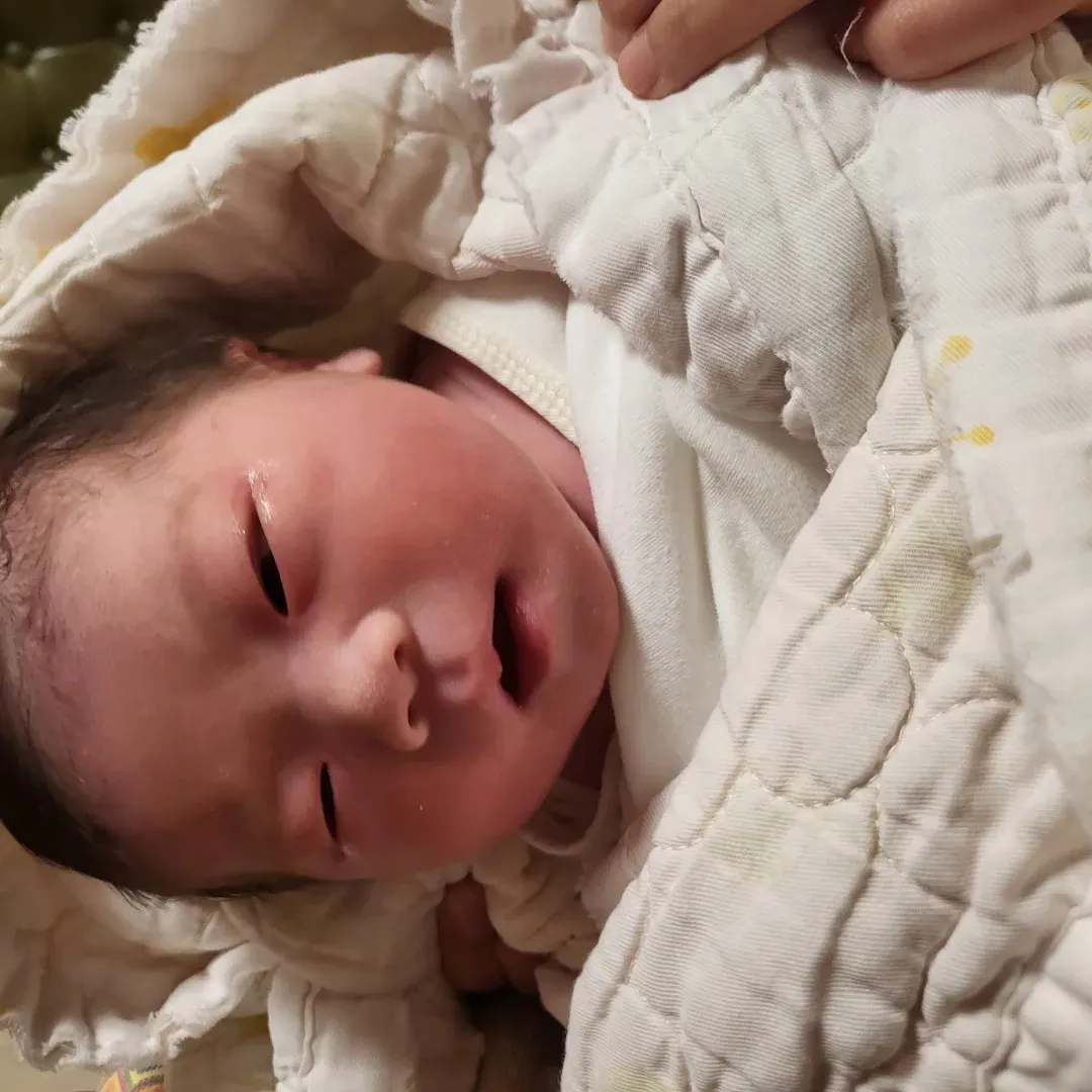 유도분만 실패 후 제왕절개ㅜㅜ