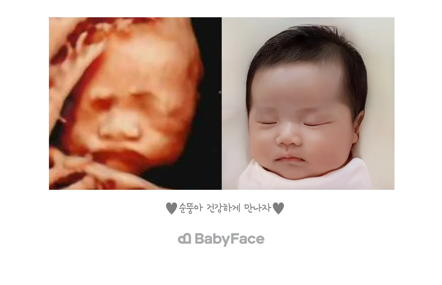 베이비페이스 후기...?