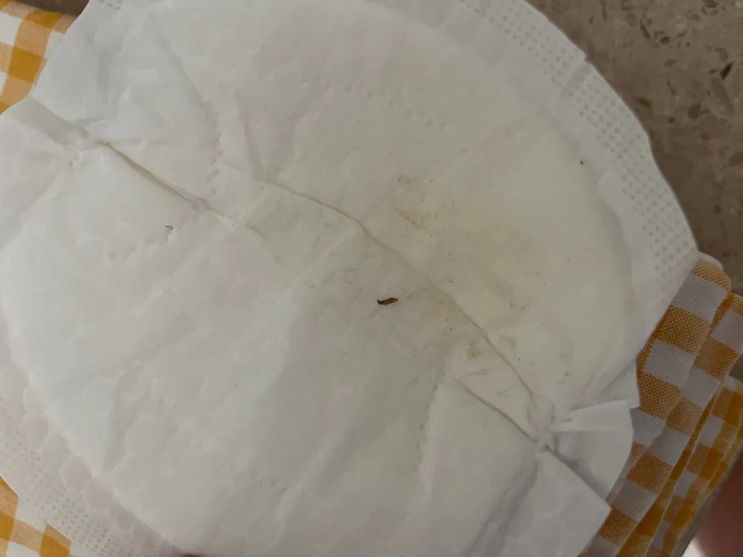 유축.직수 유두유륜 껍질까짐인가요