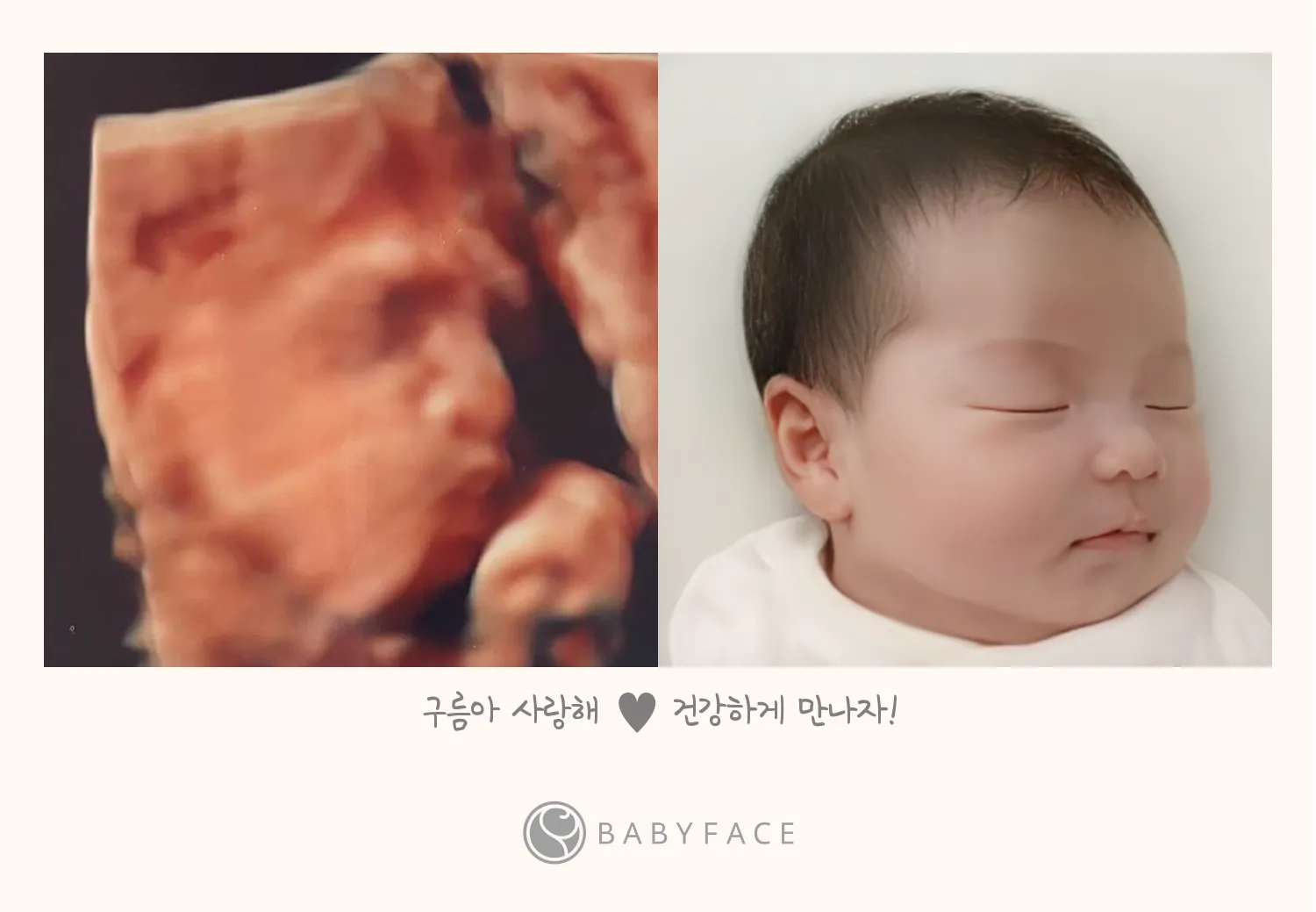 입초 후 ~ 베이비페이스