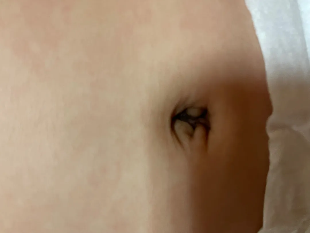 혹시 69일차 아가배꼽안에 검은색 이렇게 되는건 정상인가요..?
