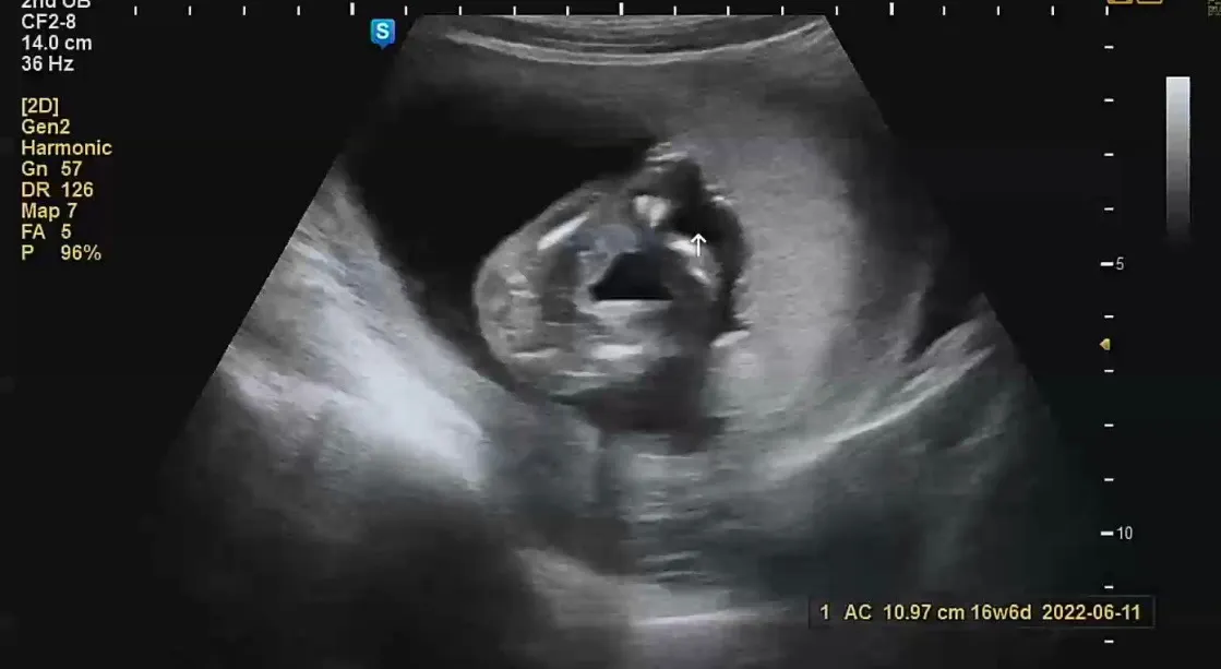 16주6일 ! 딸이확실합니다 ㅎㅎㅎ
