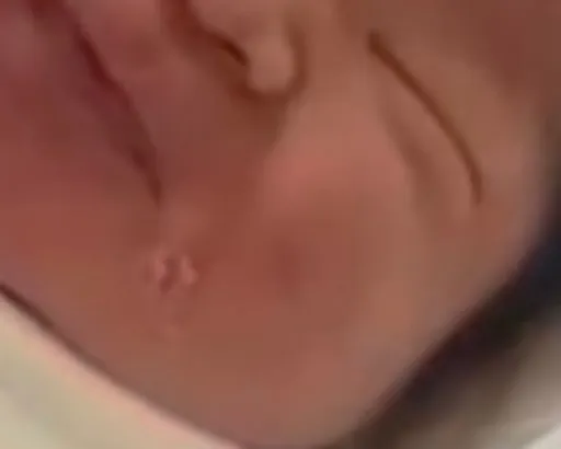 신생아실 얼굴 상처ㅠㅠ