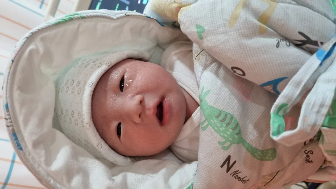 제왕절개 분만했어요