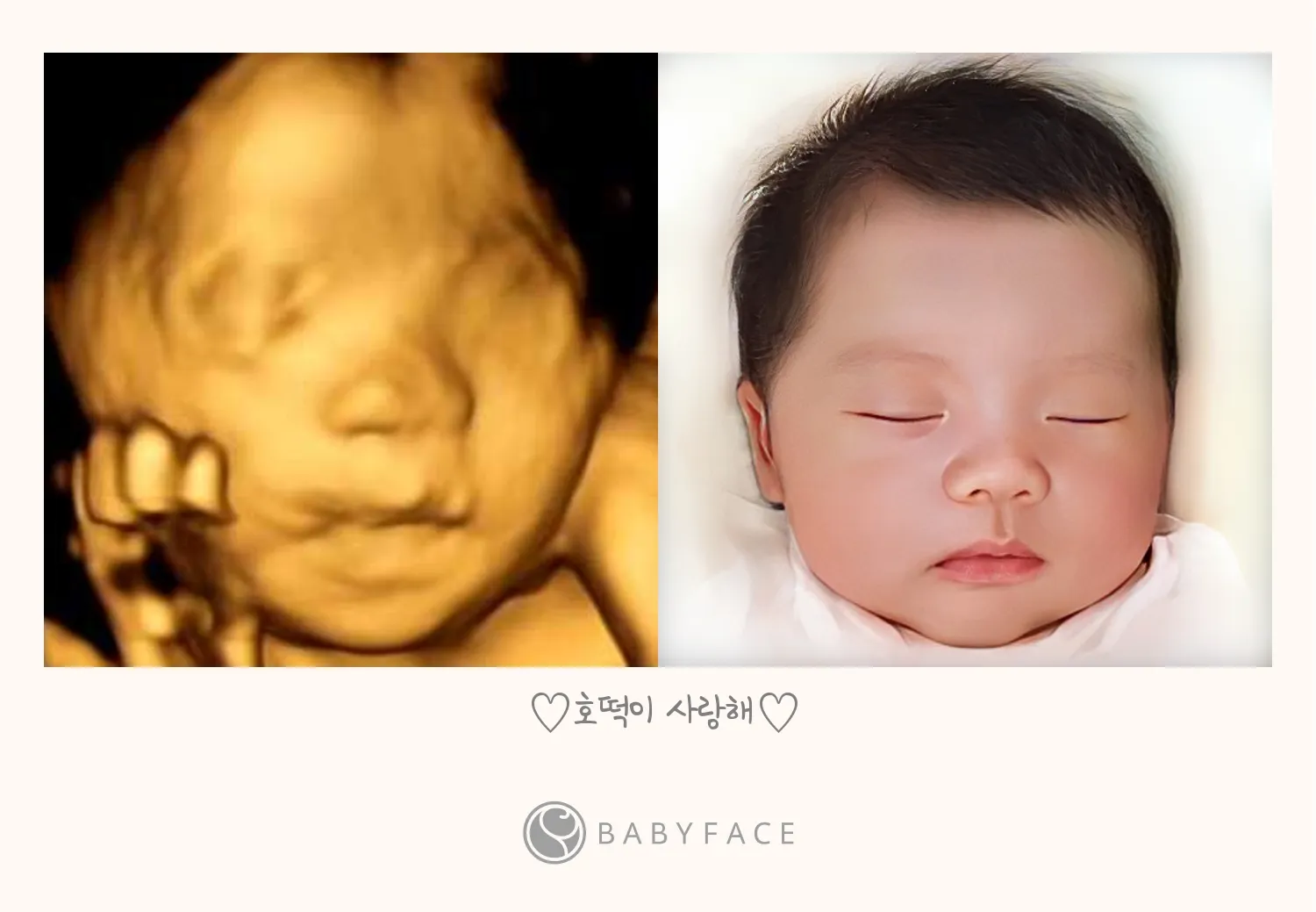 베이비 페이스 했어요😆 할인쿠폰도 사용하세요~~
