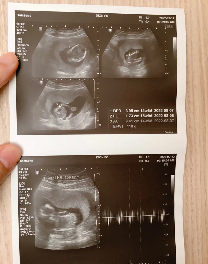 두둥 성별공개😆_15주
