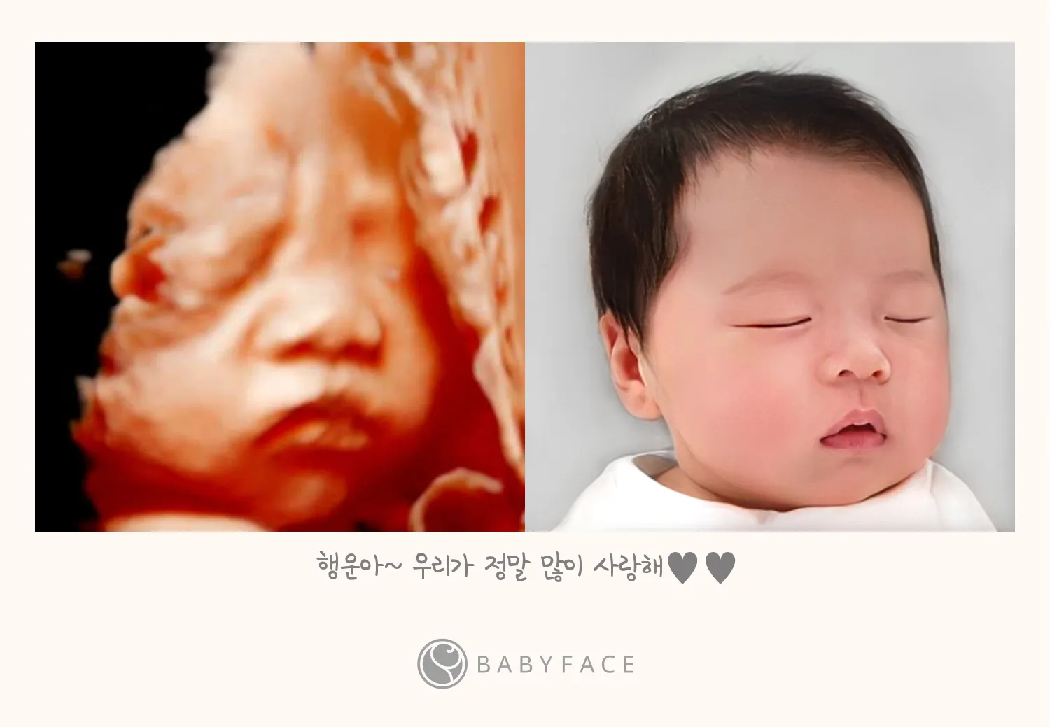 베이비페이스😍❤