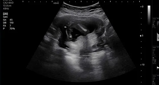 16주1일 성별좀 봐주세요