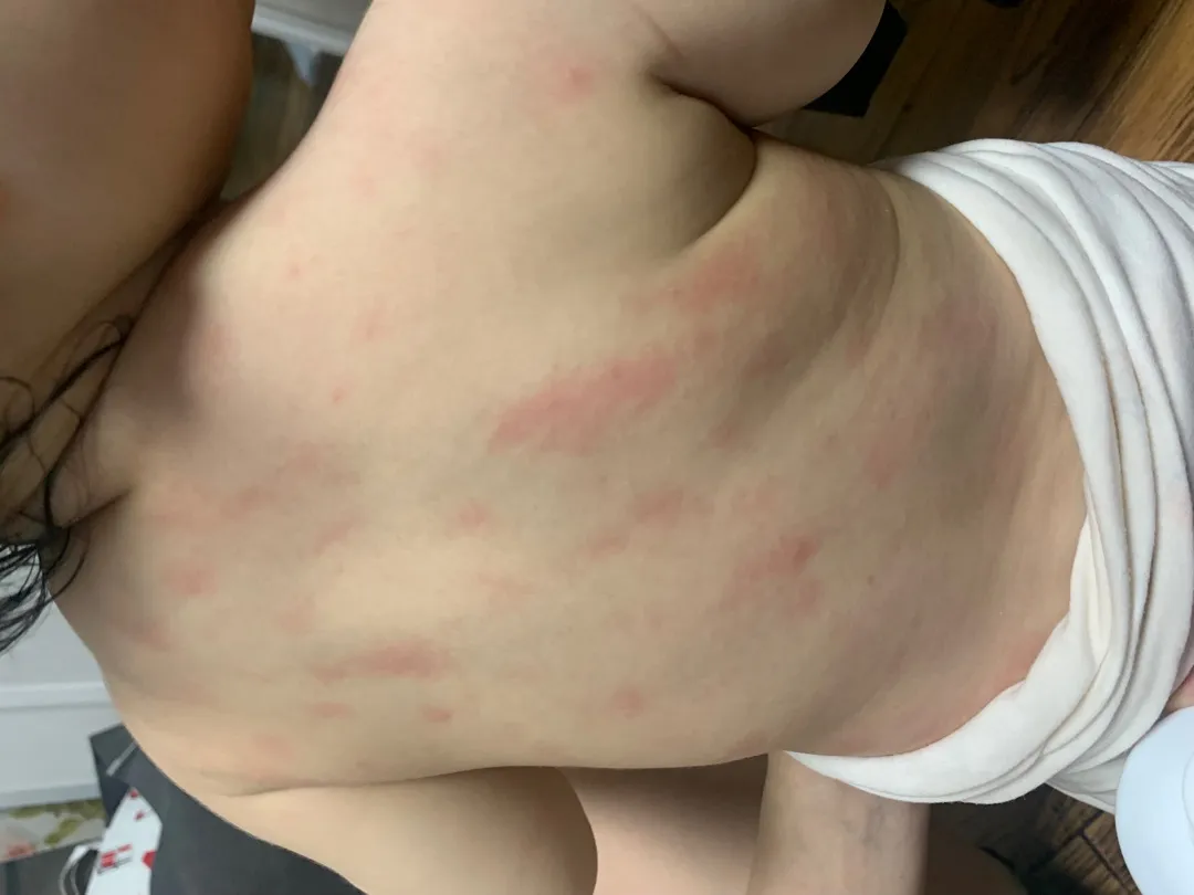 피부 왜이럴까요?