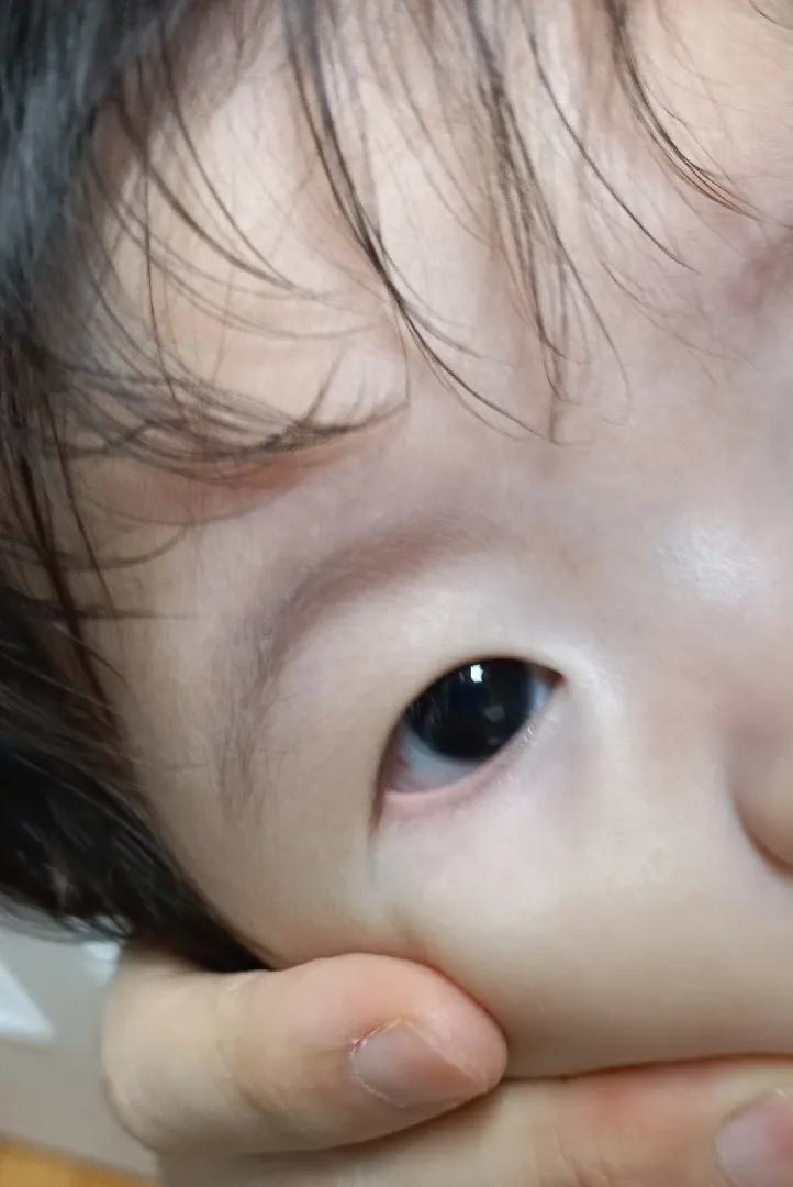 애기 눈 좀 봐주세요ㅜㅜ