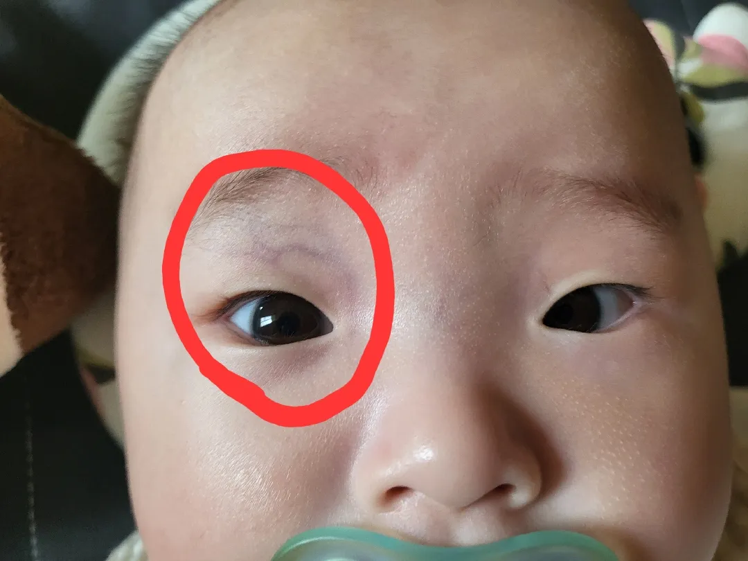 아기 눈