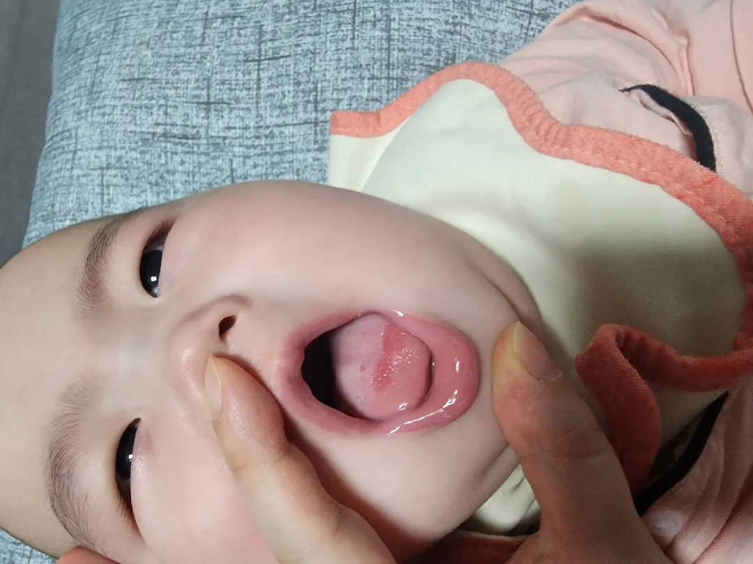 아기혀