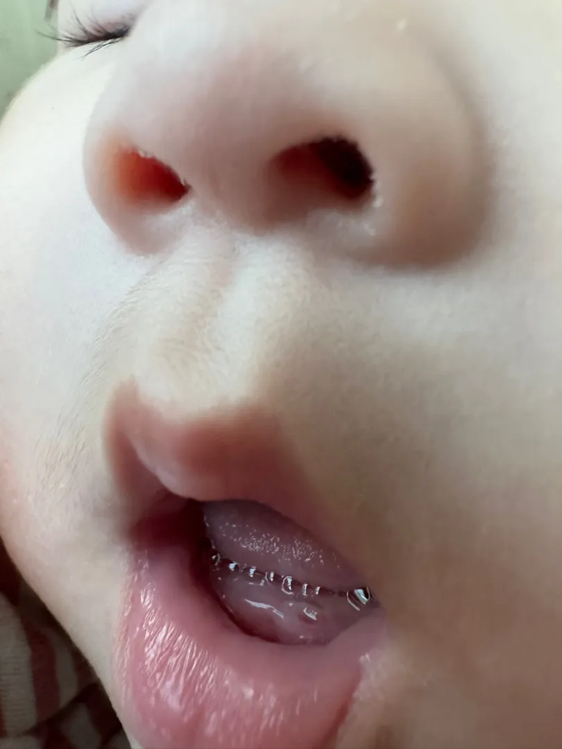 아기 잇몸 피나는데 이가 나는 걸까요?