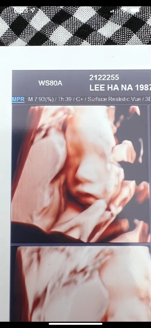 임당 입체초음파 하고 왔어요!! 임당은 아직 결과전ㅠ