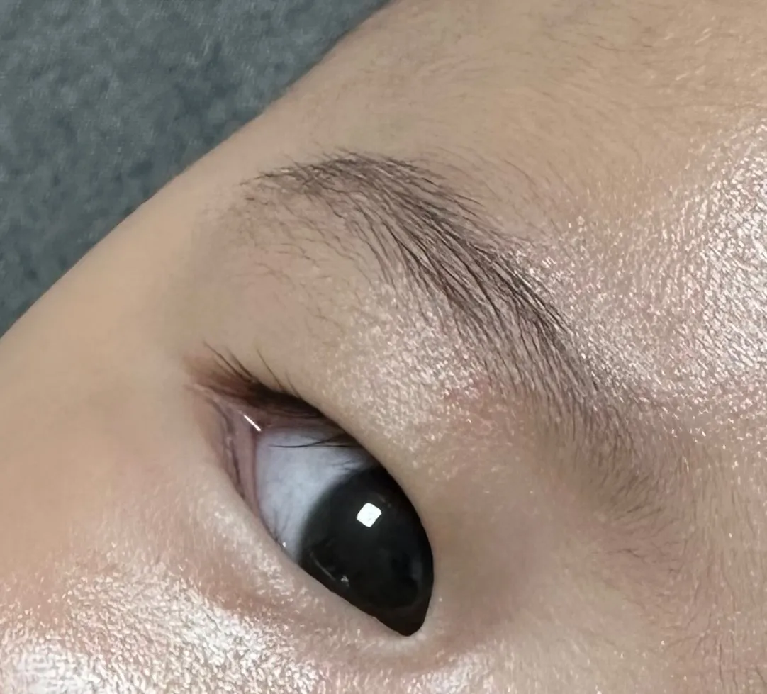 아기 눈 충혈