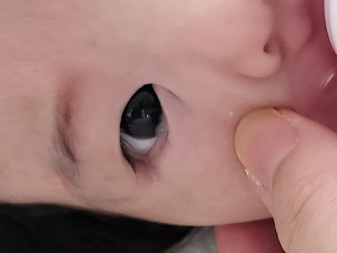 눈꼽이 이렇게 끼나요!?