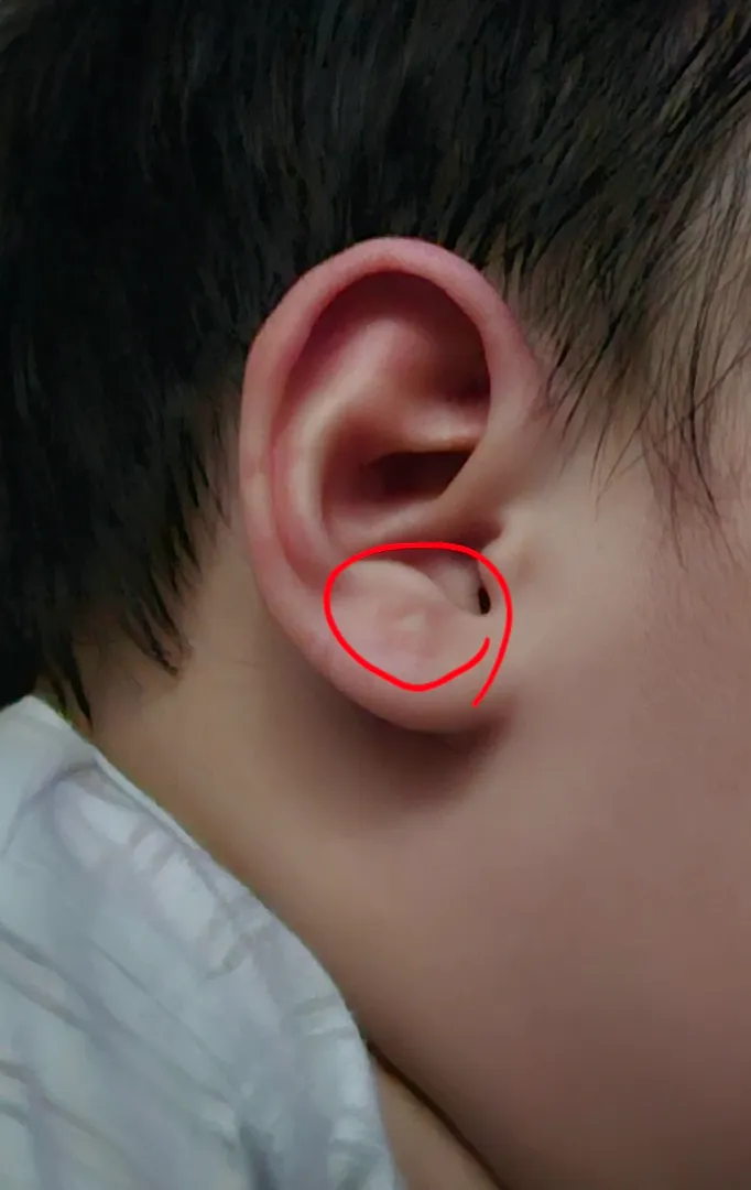 혹시 애기귀에 이런거 보신적이세요?😳