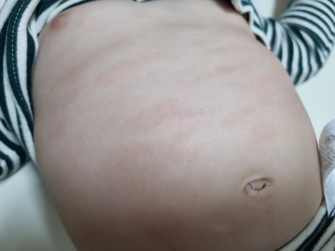 몸에 자국이 많이 생겼는데 아시는분 계실까요 ㅠㅠㅠ