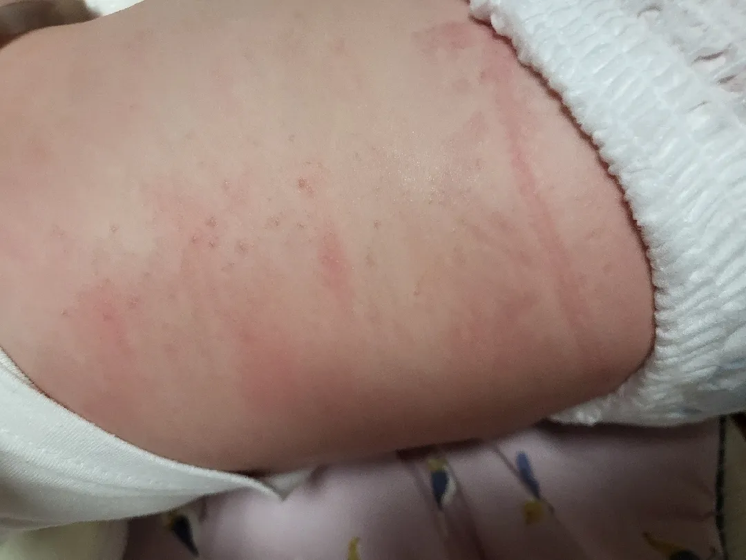 7개월 노른자 테스트 