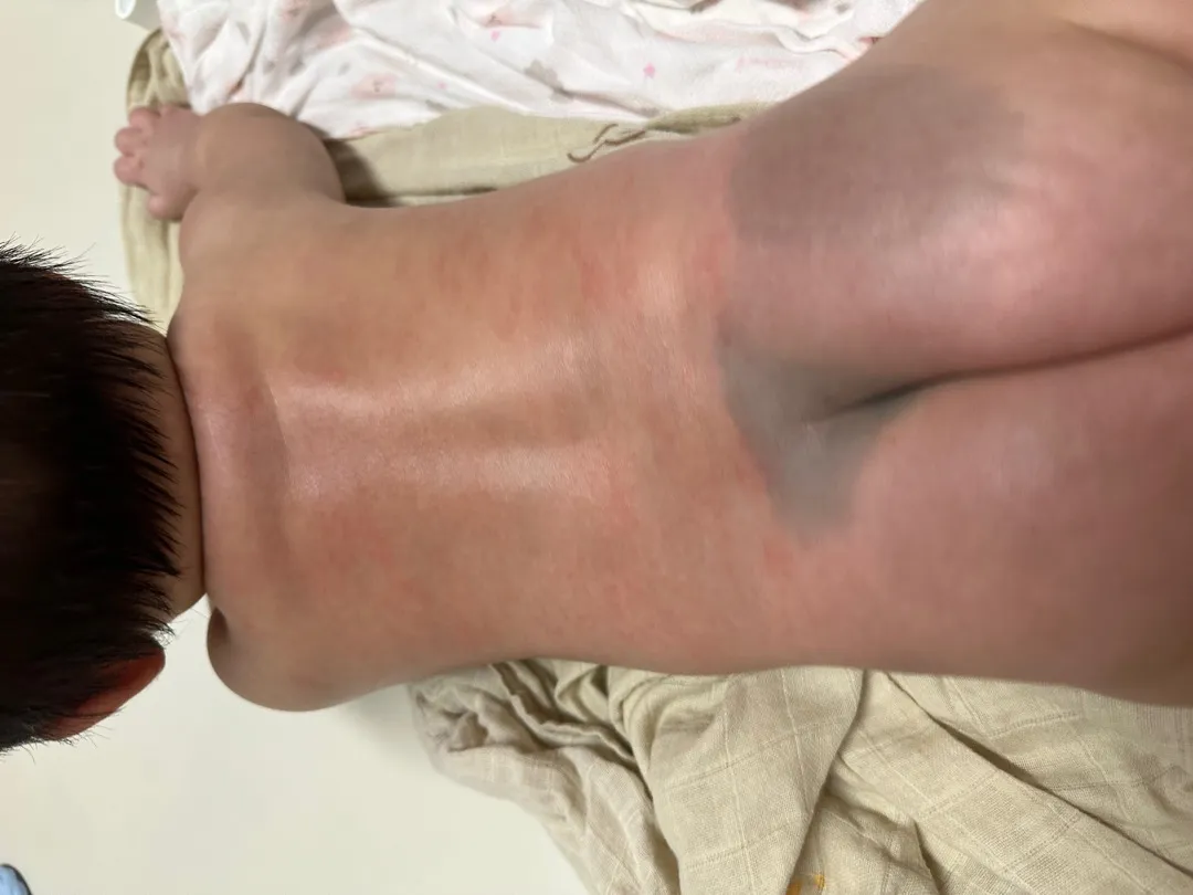 태열맞나여