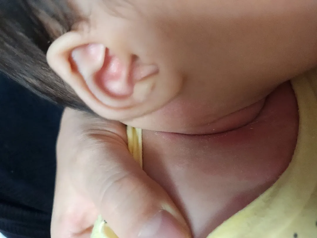 아기 목