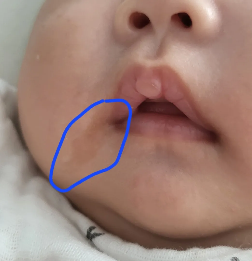아기 입 주변 피부색