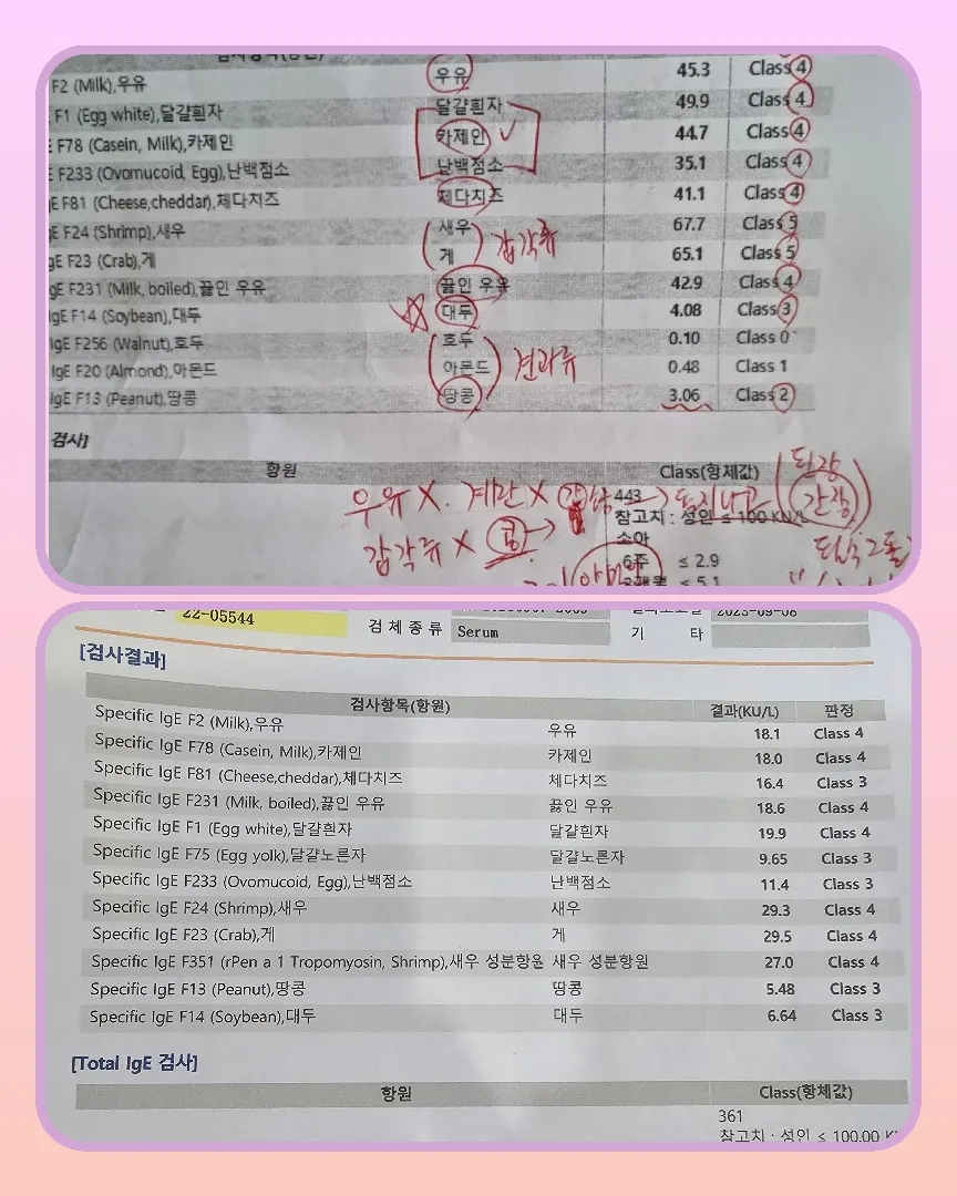 알레르기재검결과