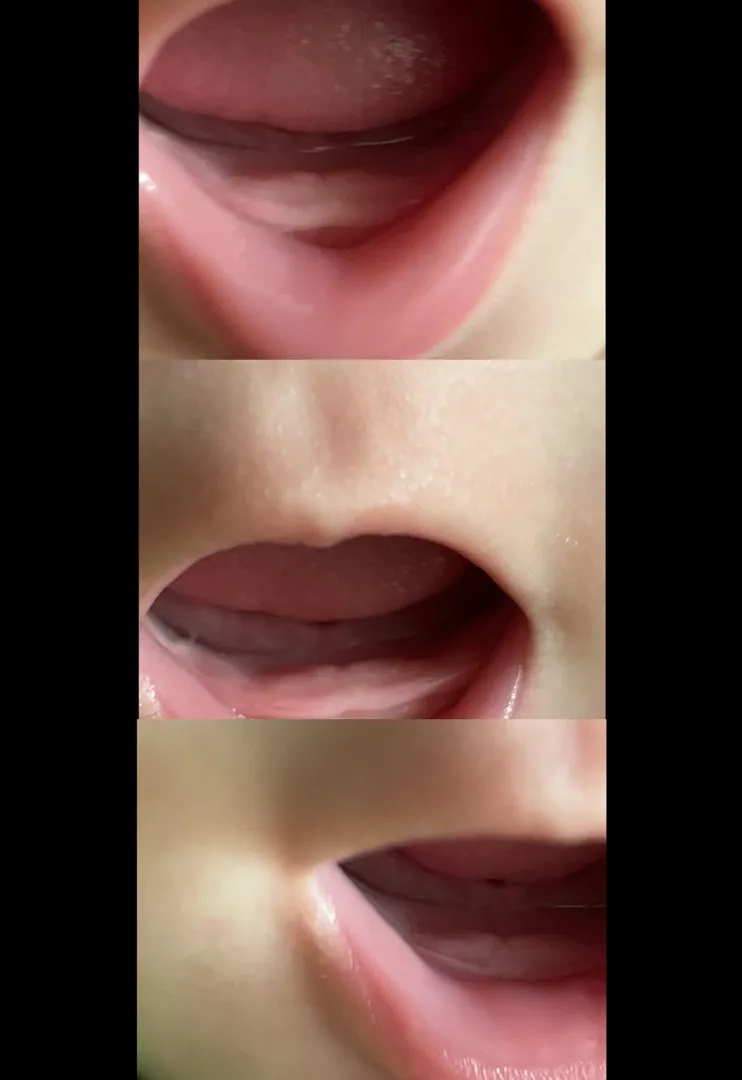 이가 나려는 걸까요?