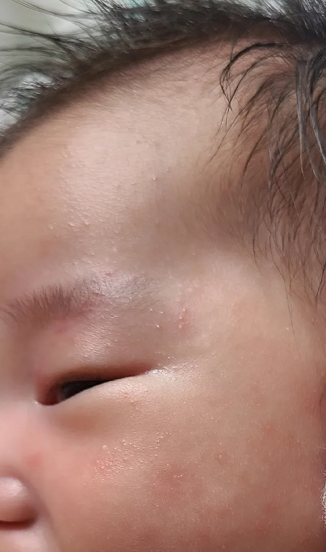 아기 태열일까요?