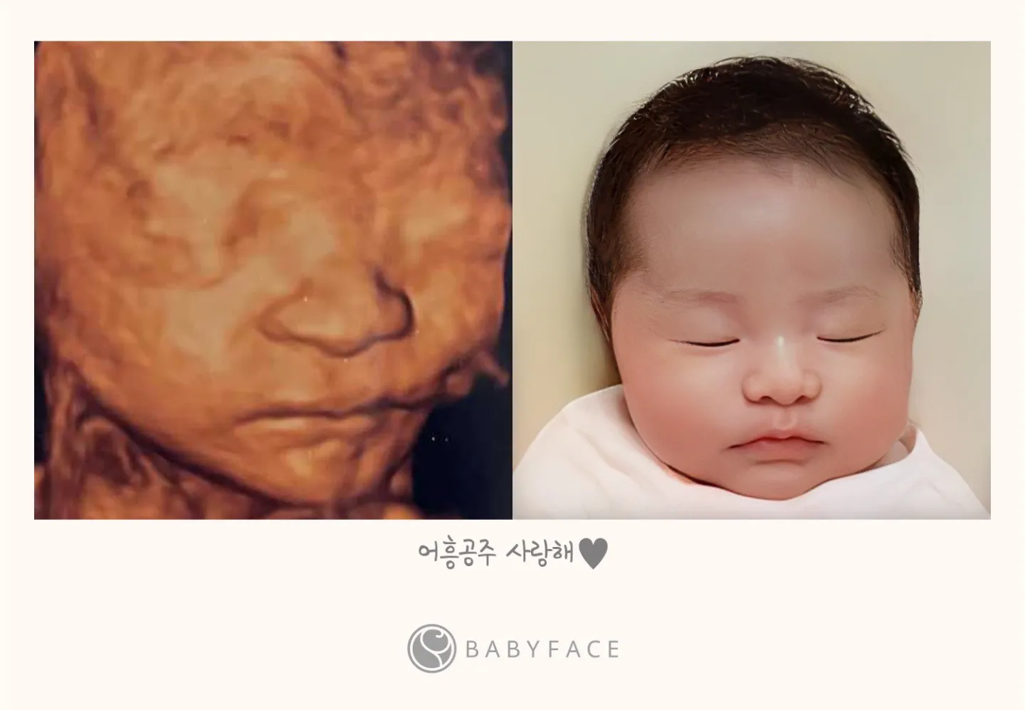 딸랑구 입체촘파로 베이비 페이스 했어용💟
