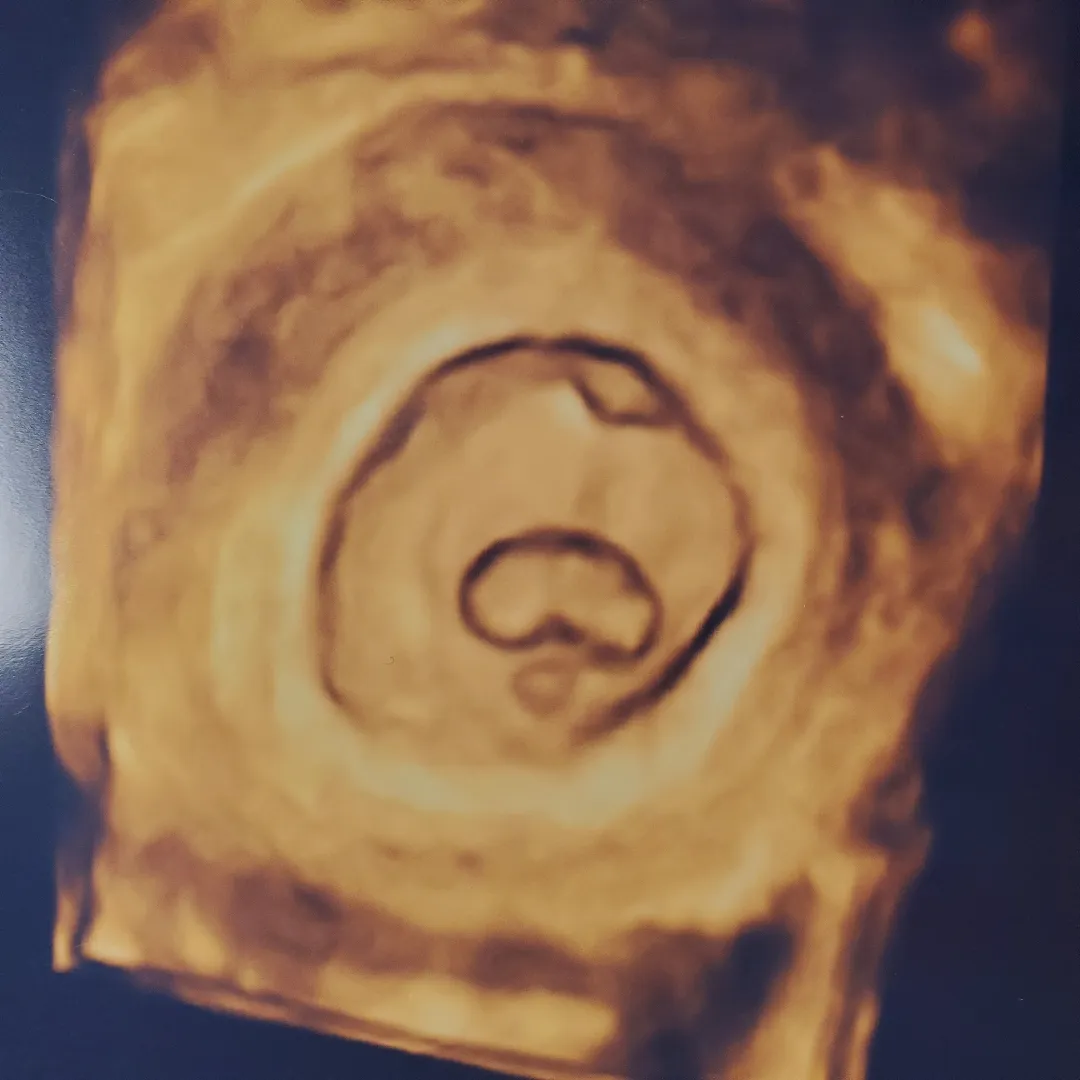 community post image