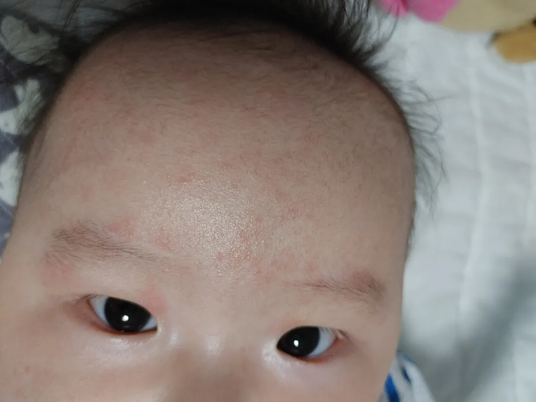 150일된 남아인데...이건  뭘까요?