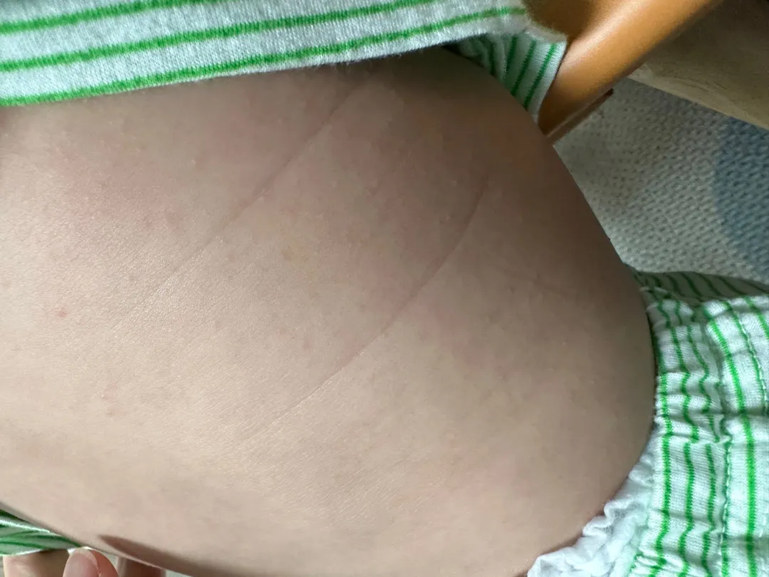 아기 피부좀 봐주세여 ㅠㅠ