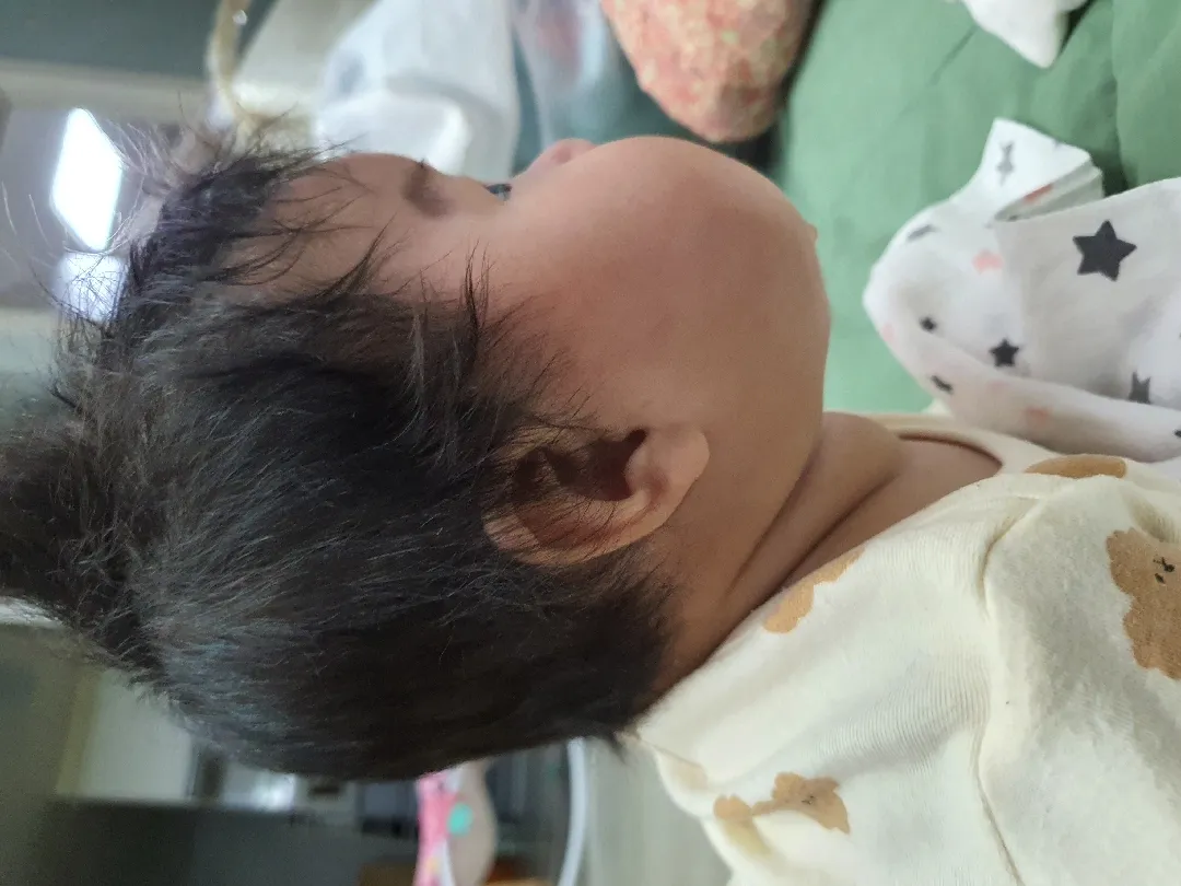사두증 단두증 걱정이예요