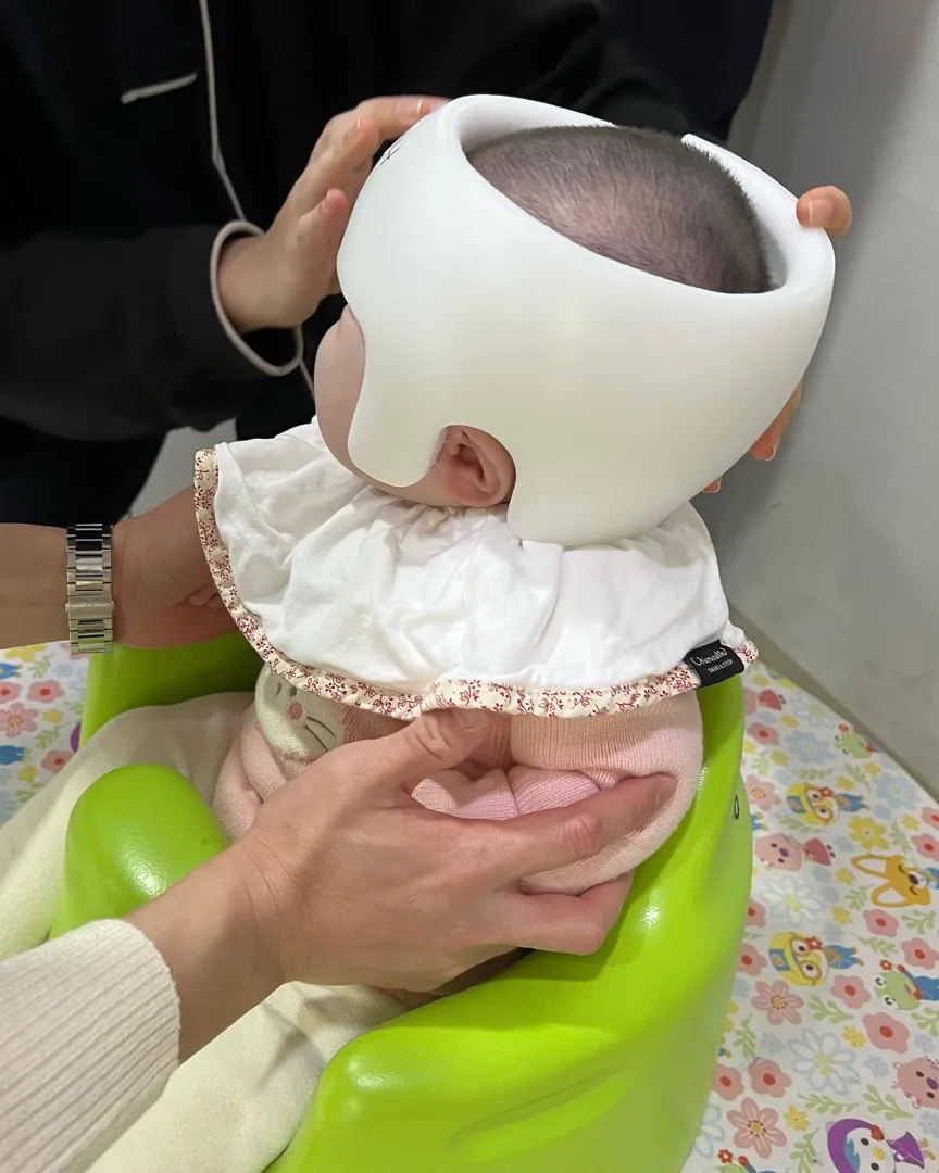 사두증+단두증 대전 지오헬멧 교정 후기