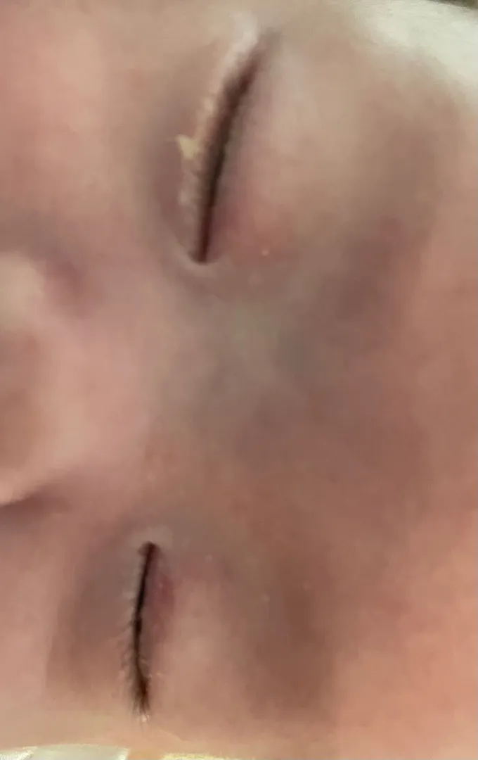 54일차 아기 눈꼽 (눈물은 언제?) 