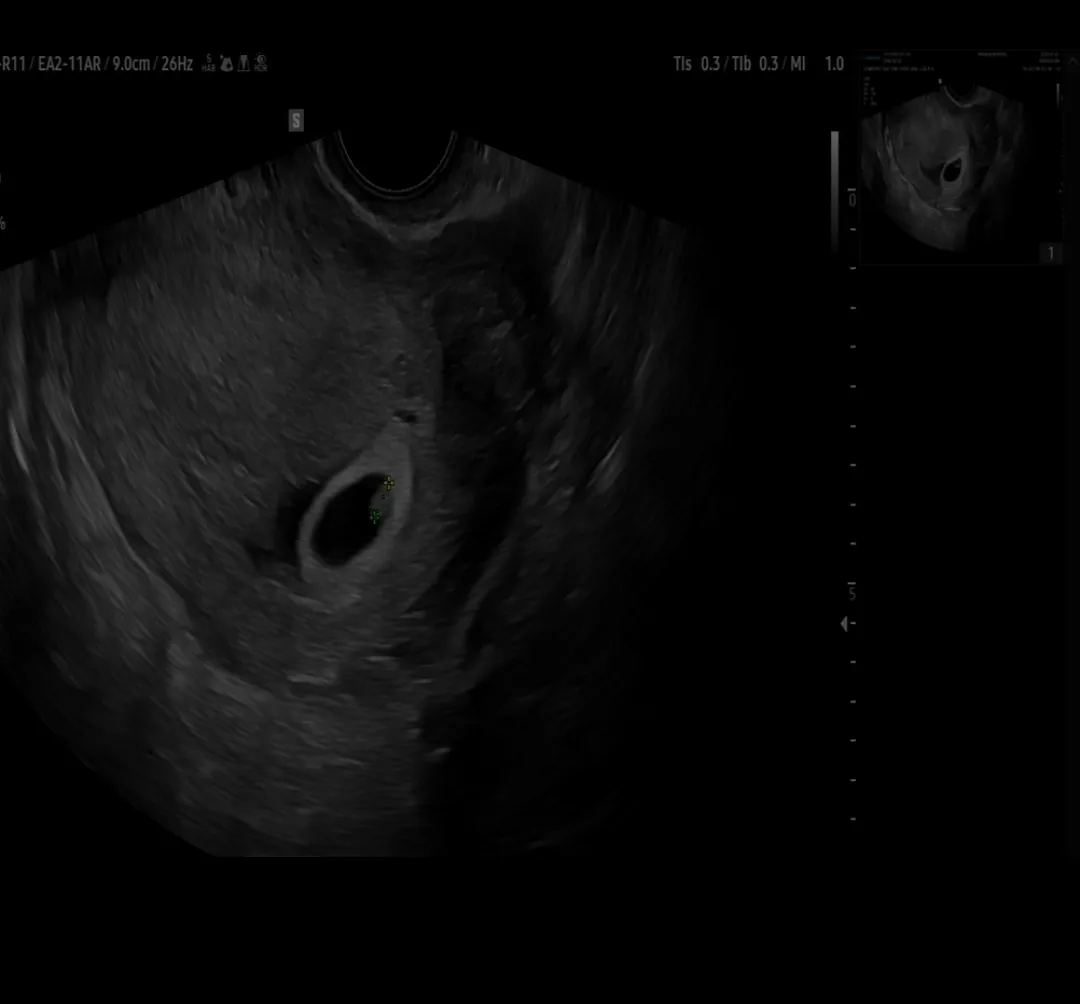 6주3일차 심소듣고왔어요👶🫁👶