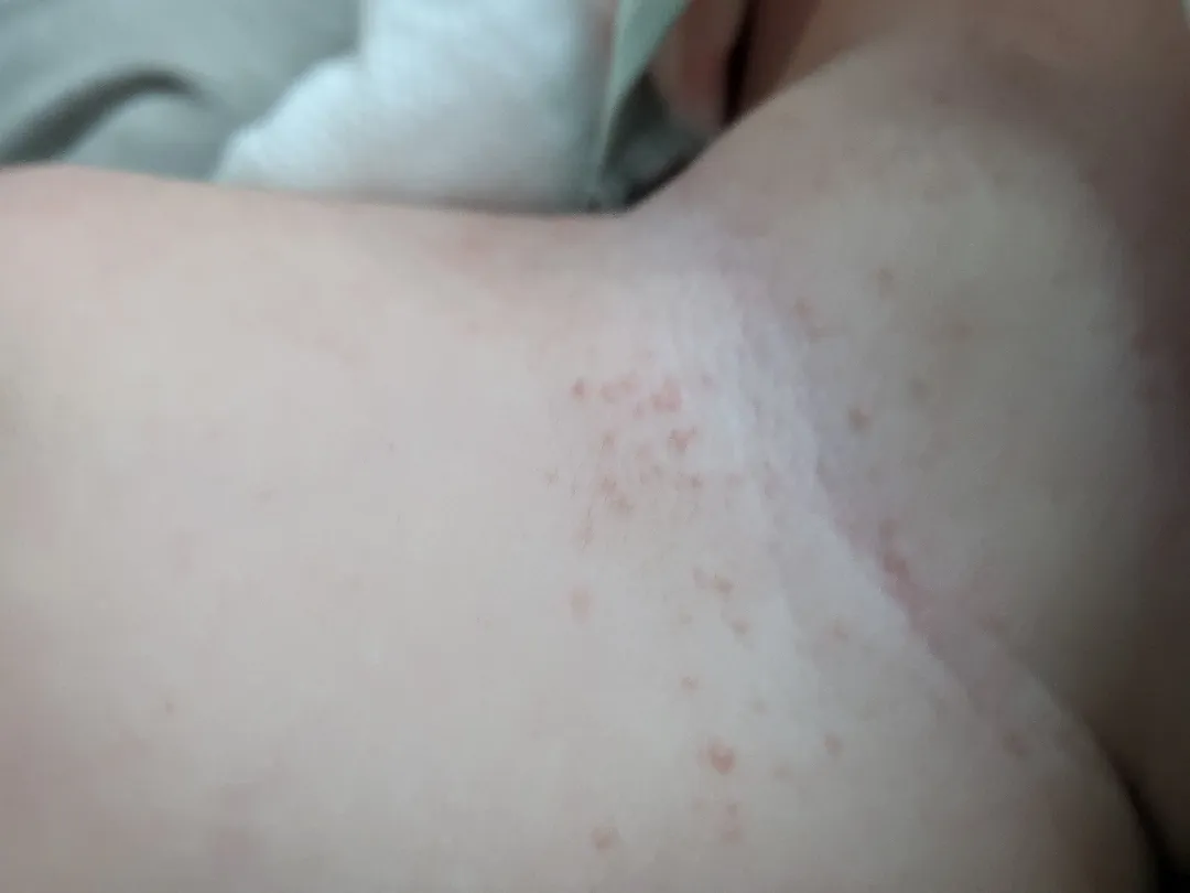 아기 목 어떻개 해야할까요 ㅠㅠ