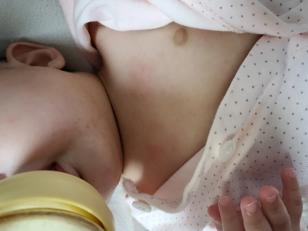 이유식이 얼굴에 뭍으면 트러블 날 수 있는거죠?