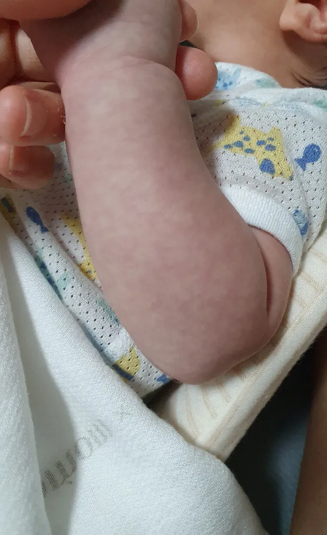 아기 피부좀 봐주세요