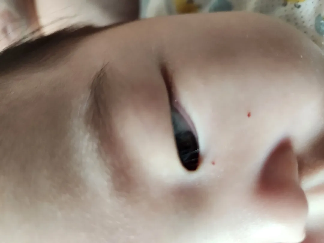 얼굴상처