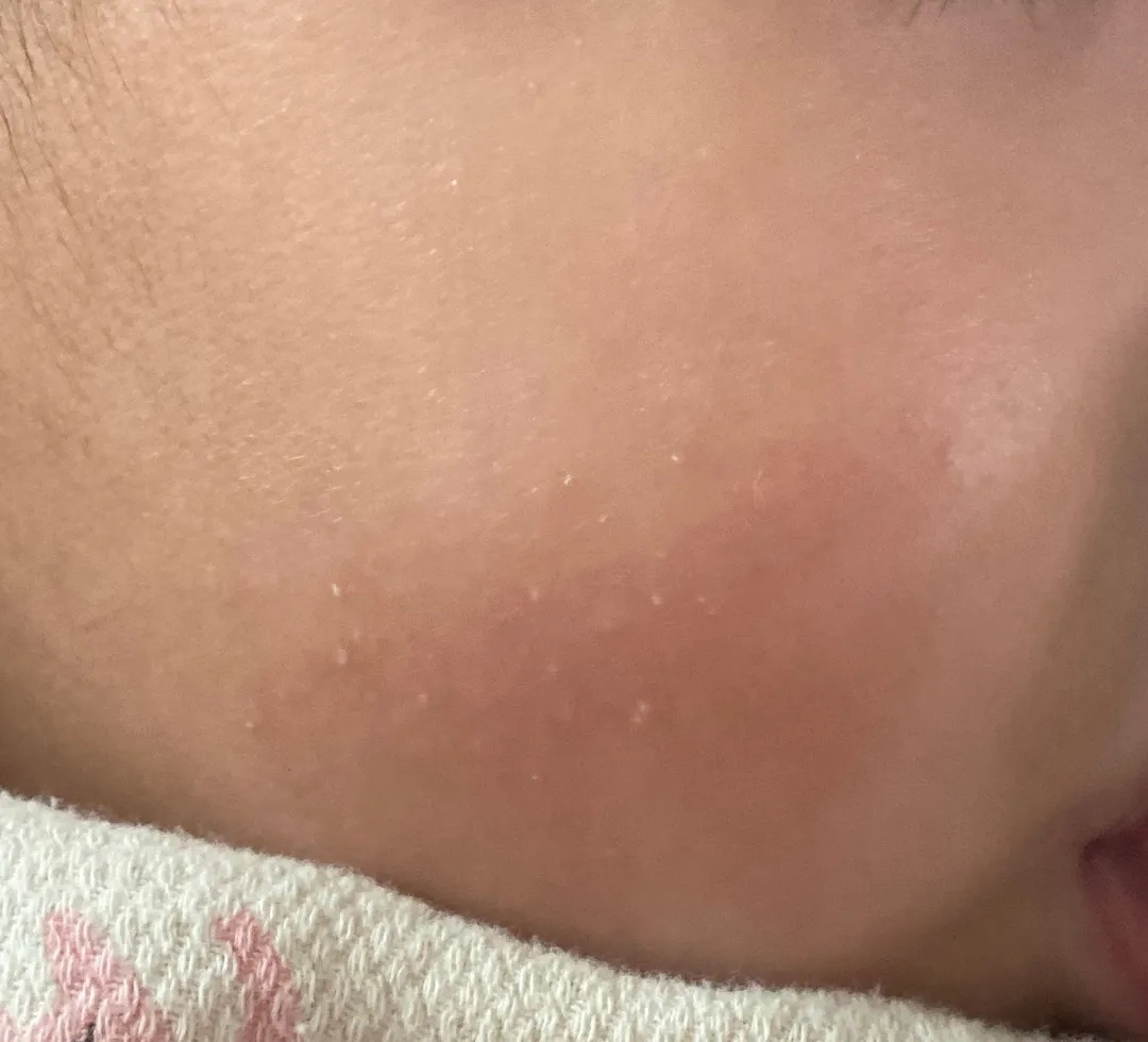 아기 볼 좀 봐주세요ㅠ