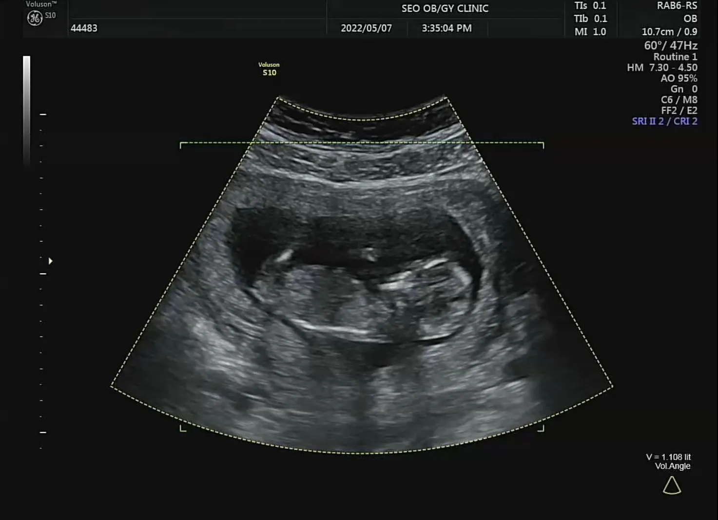 community post image