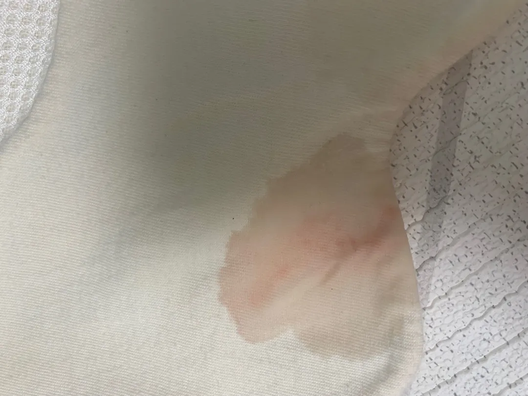 아기 침에서 피가나왔어요ㅠㅠ