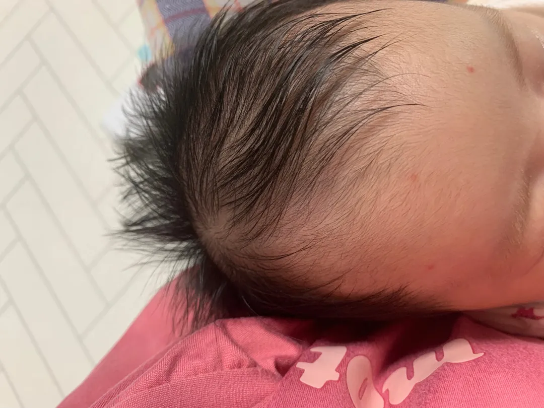 40일차 아기얼굴에 빨간반점, 힙분유질문있어요!