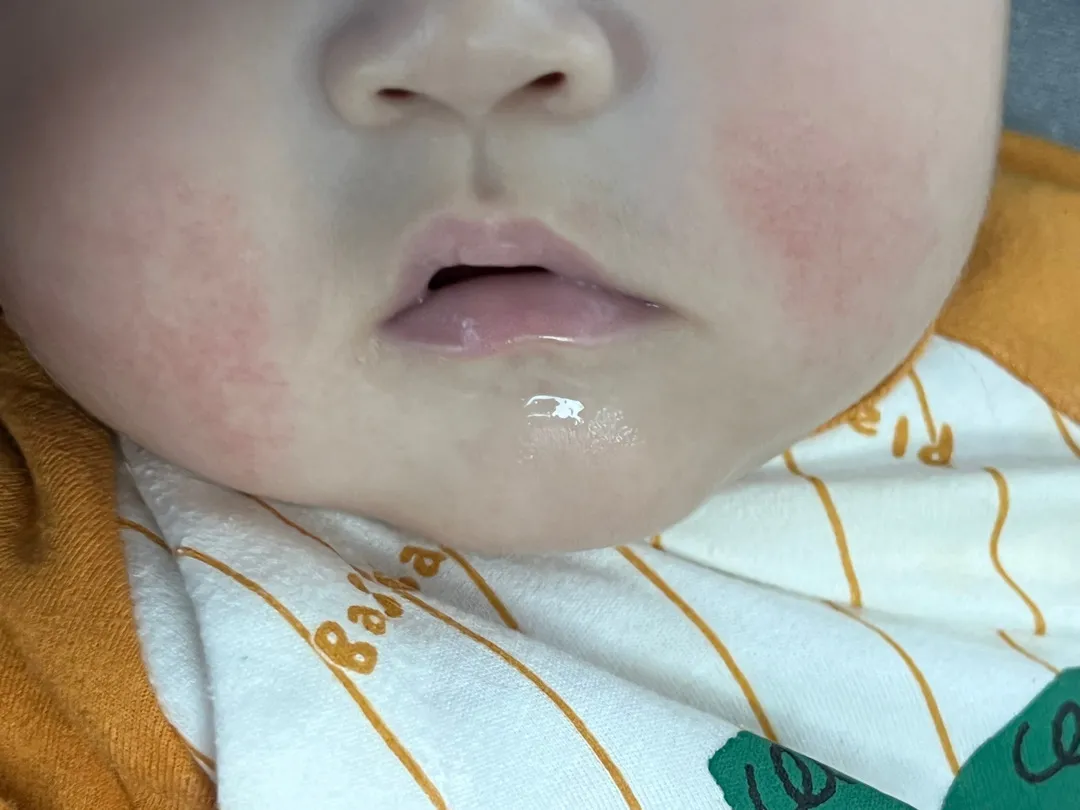 피부과 가야하나요?