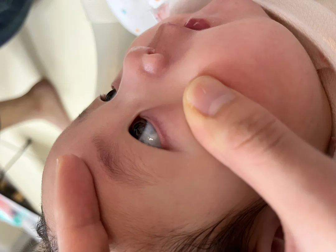 아기 눈 흰자에 검정색 반점? 아시는분 ㅠㅠ