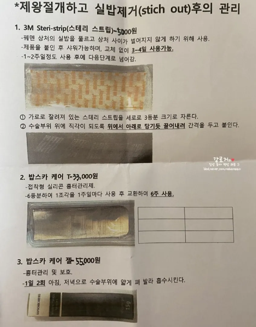 제왕절개흉터요 🥲