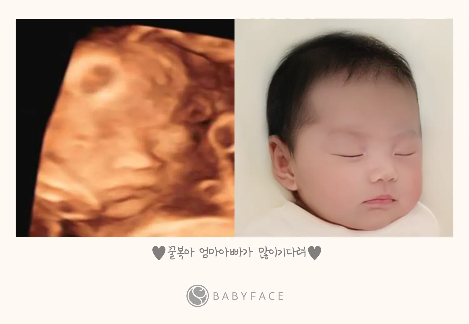 우리아기 베이비페이스